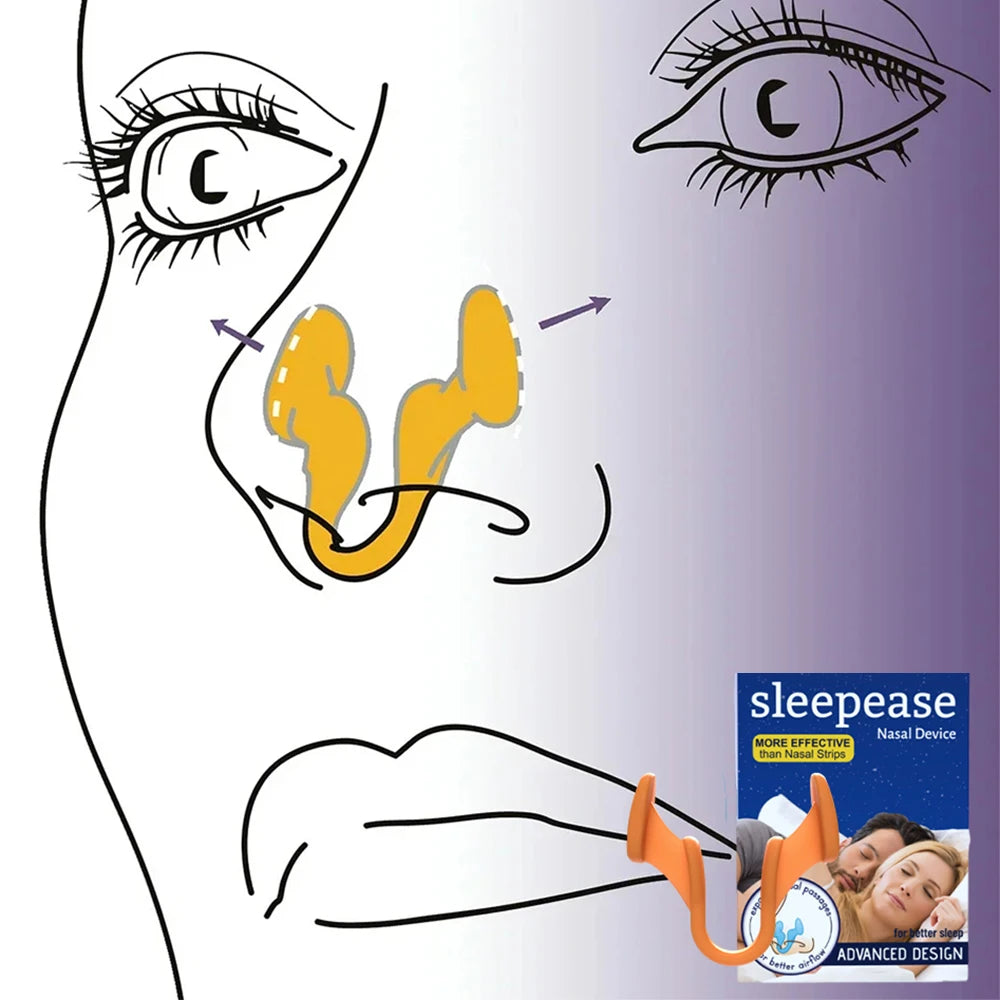 Siliconen Neusclip tegen Snurken – Anti Snurken Nasale Dilator, Verbeter de Slaap en Ademhaling, Verlichting van Rhinitis