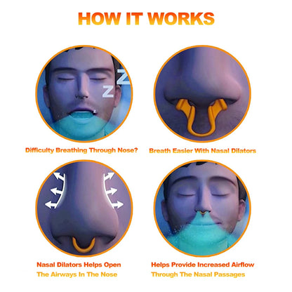 Siliconen Neusclip tegen Snurken – Anti Snurken Nasale Dilator, Verbeter de Slaap en Ademhaling, Verlichting van Rhinitis